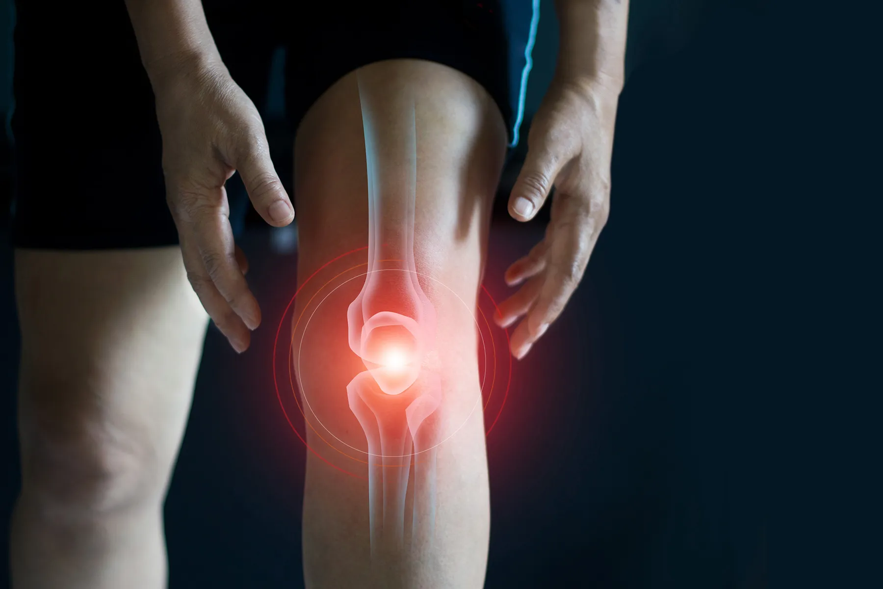 6 Ways to Cause Knee Damage and Ruin Your Knees